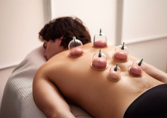 Cupping Therapy