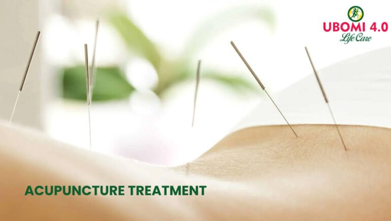 Acupuncture treatment