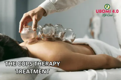 cups therapy treatment