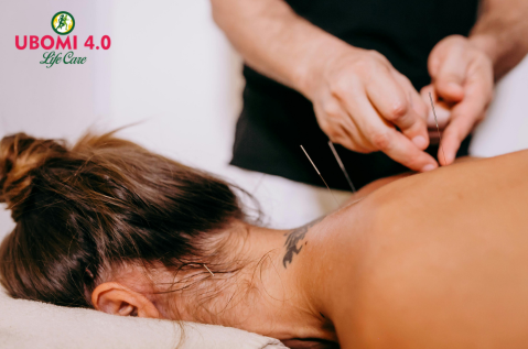 acupuncture points for pain relief