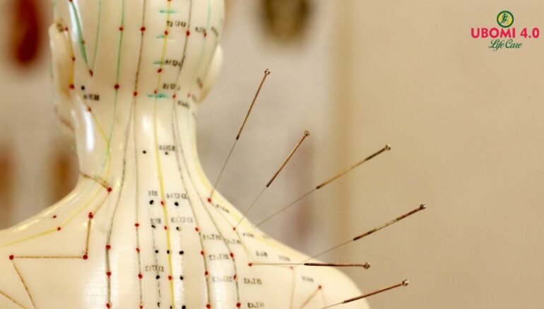 acupuncture points for pain relief