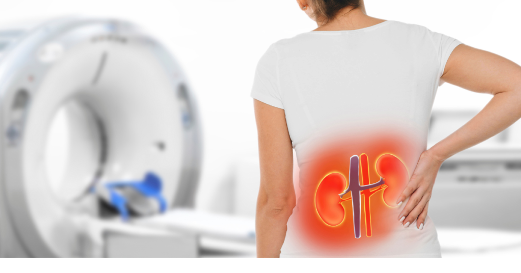 Naturopathy treatment for kidney stones