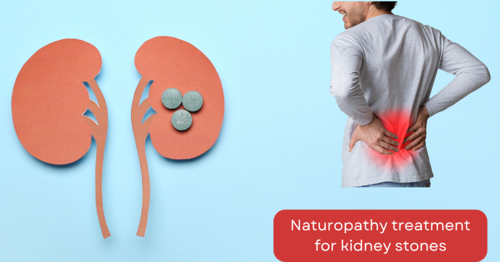 Naturopathy treatment for kidney stones