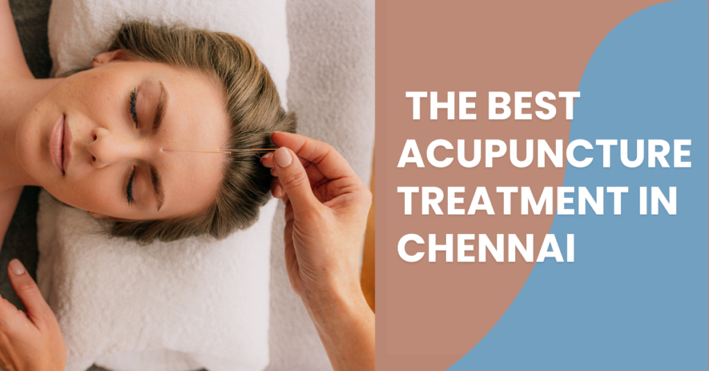 best acupuncture treatment in chennai