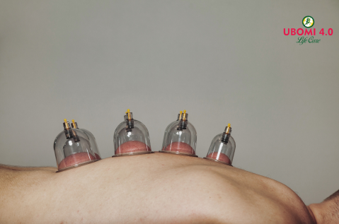 dry cupping therapy