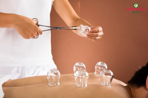 cupping therapy in chennai