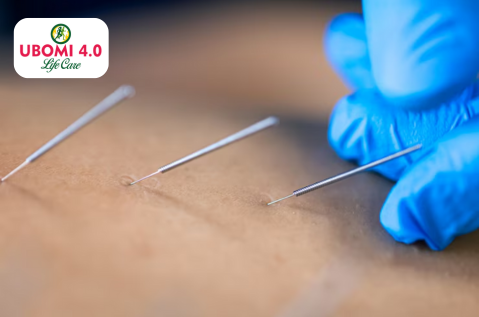 Acupuncture Treatment